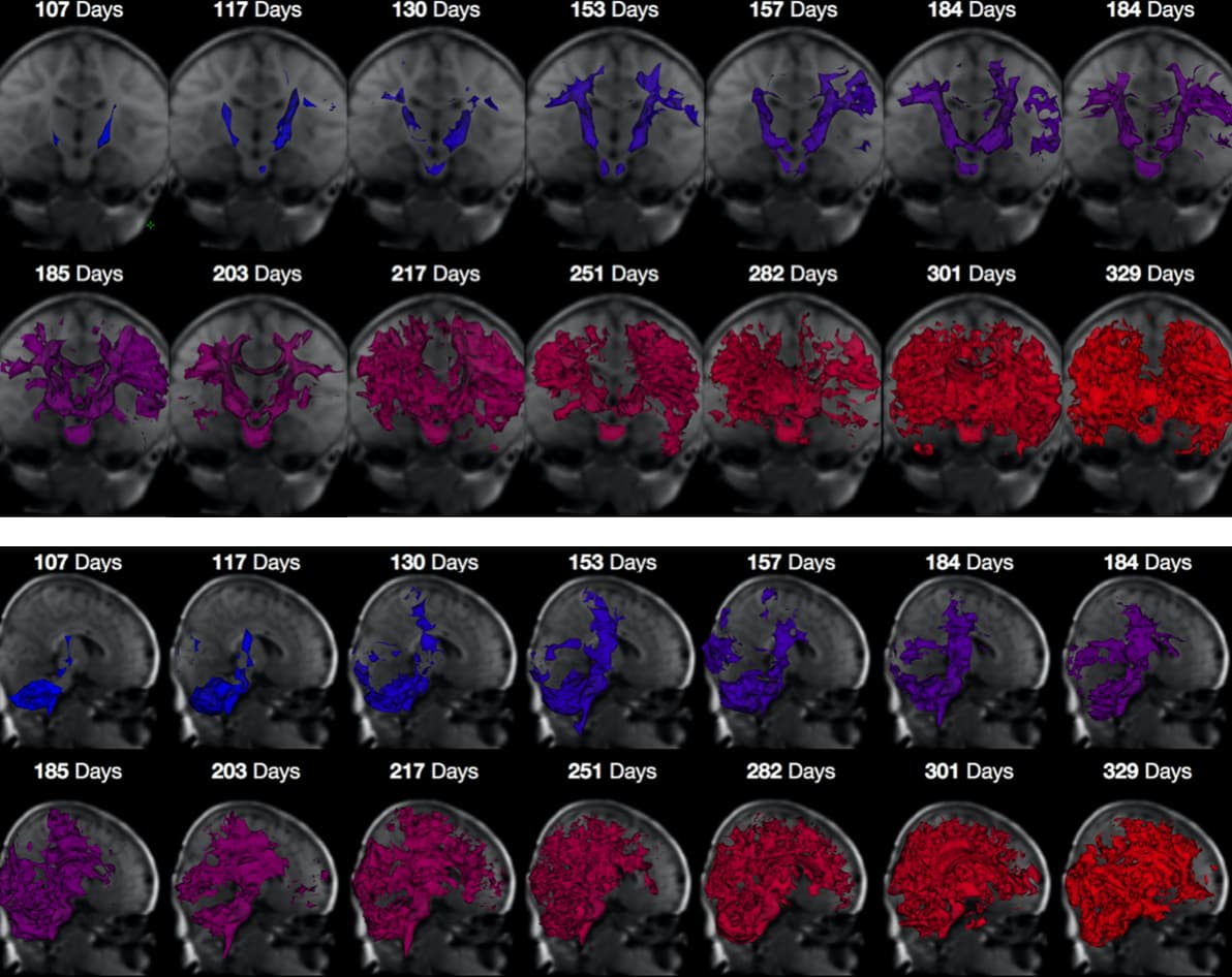 Content Feature Image