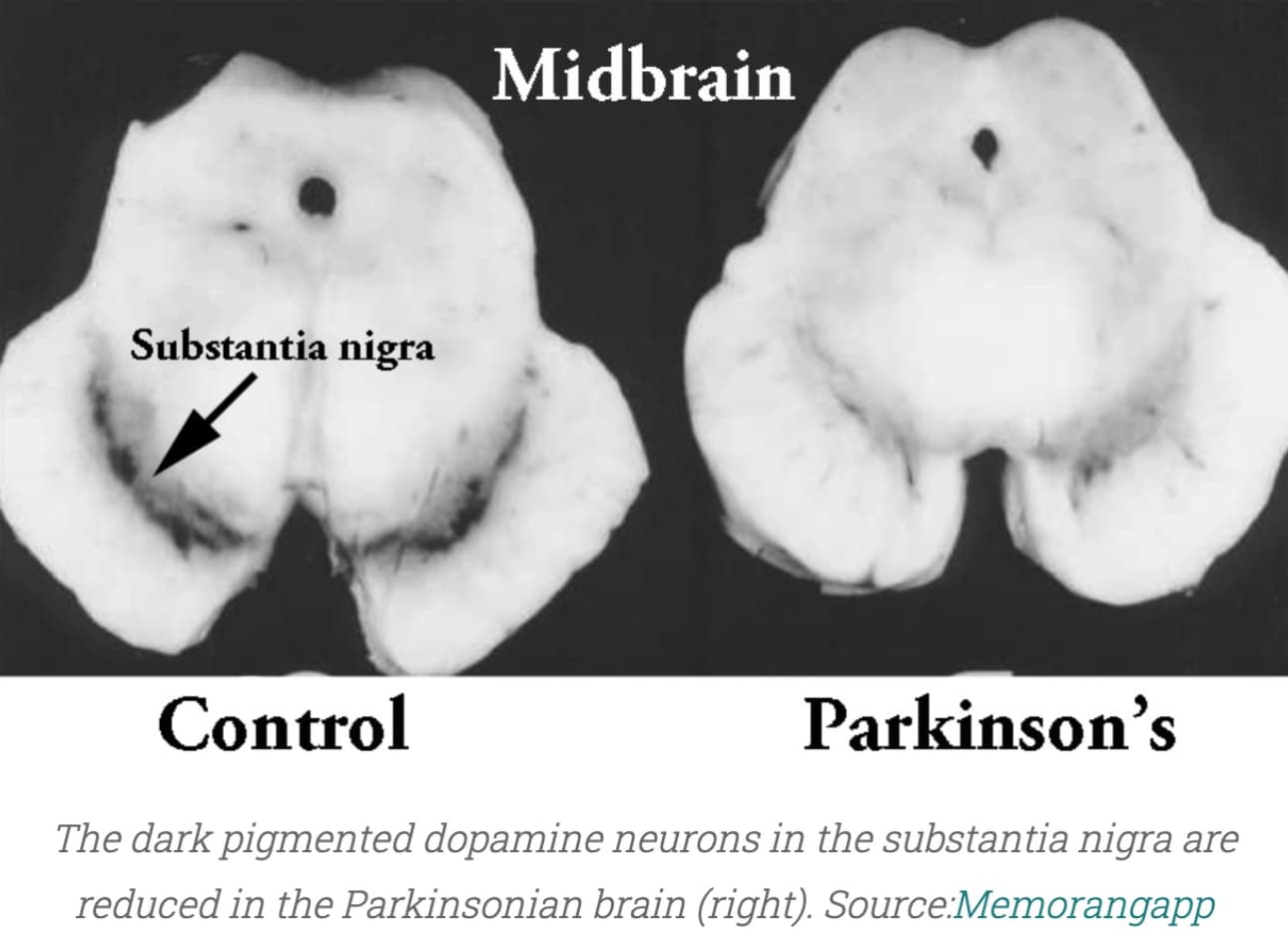 Content Feature Image